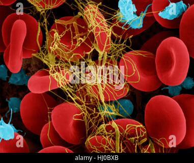Human red blood cells activated platelets trapped in fibrin blood clot,composite coloured scanning electron micrograph (SEM).Platelets in blood are small oval disks are termed nonactivated platelets or thrombocytes.Platelets serve as body's first line of defence to prevent excessive blood loss.When Stock Photo