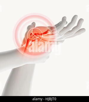 Wrist painful - skeleton x-ray, 3D Illustration medical concept. Stock Photo