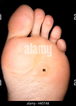 health, medicinally, medical, pain, foot, feet, toe, woman, health, detail, Stock Photo