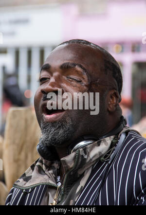 Middle aged partially bald man with a head injury with twelve stitches ...