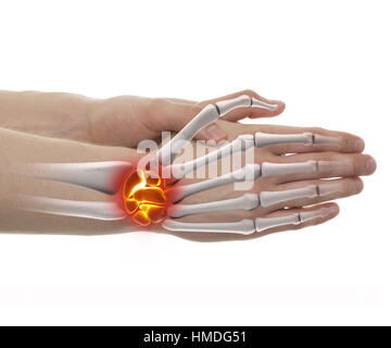 Wrist Pain - Studio shot with 3D illustration isolated on white Stock Photo