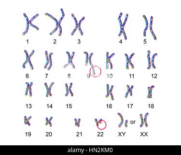 Philadelphia chromosome.Computer illustration of male or female ...