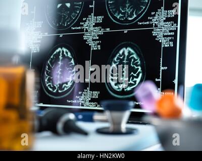 Magnetic resonance imaging (MRI) scans of the human brain Stock Photo ...