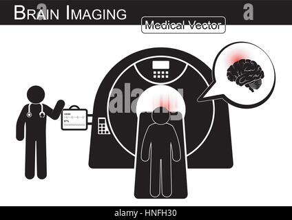 Brain Imaging .  Patient lie on CT scanner for diagnosis of brain disease ( Hemorrhagic or Ischemic stroke , Brain tumor , Brain abscess , etc ) ( Bla Stock Vector