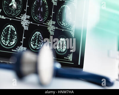 Series of MRI brain scans on computer screen with stethoscope in foreground on doctor's desk Stock Photo