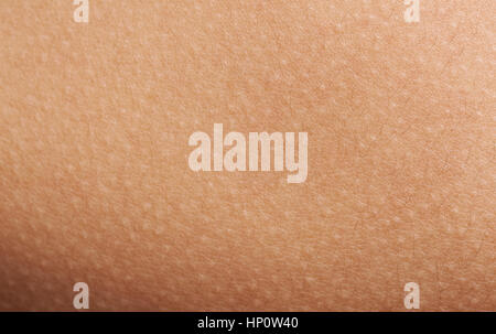 Goose bumps on human skin macro. Texture of skin with goosebumps Stock Photo