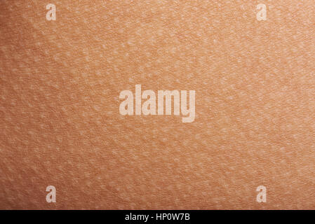 Goose bumps on human skin closeup. Tecture of skin with goose bumps Stock Photo