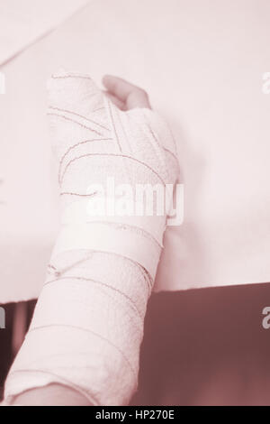 Doctor applying a plaster cast and bandages to patient forearm and wrist to immobilize after fracture injury. Stock Photo
