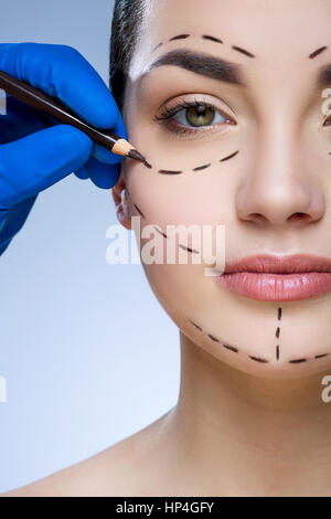 Perforation lines on patient's face Stock Photo