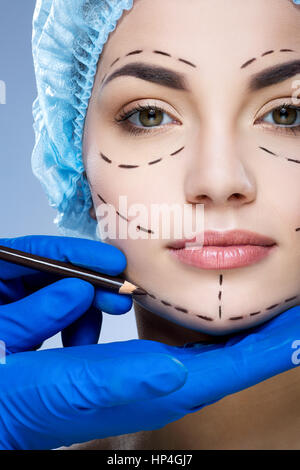 Perforation lines on patient's face Stock Photo