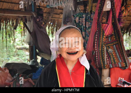 Big Ear Karen tribe elderly woman with large pierced earlobes and blackened teeth in Chiang Mai, Thailand Stock Photo