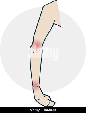 Problems with the limb joints. Illustration of a funny cartoon style Stock Vector