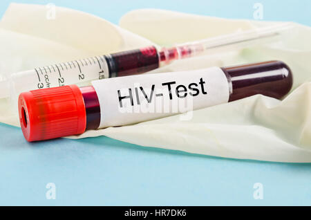 Sample blood for screening test for HIV test and syringe on glove in laboratory. Stock Photo