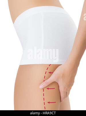 Woman squeezing rear thigh with the drawing red arrows, Lose weight and liposuction cellulite removal concept, Isolated on white background. Stock Photo