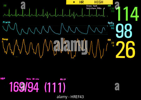 Vital signs monitoring in ICU unit Stock Photo - Alamy