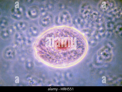 LM of Balantidium coli, a parasitic protozoan Stock Photo