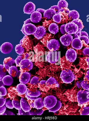 Staphylococcus Epidermidis Bacteria, SEM Stock Photo