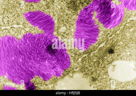 Beet Necrotic Yellow Virus, TEM Stock Photo