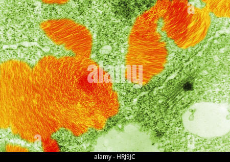 Beet Necrotic Yellow Virus, TEM Stock Photo