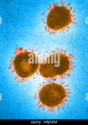 Infectious Bronchitis Virus, TEM Stock Photo