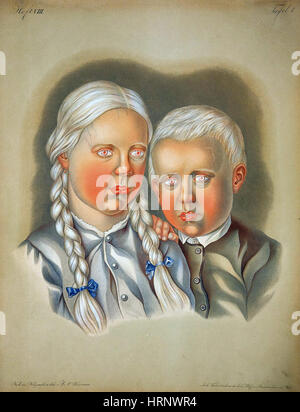 Albino Children, 19th Century Stock Photo