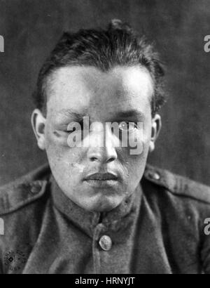 WWI, Wounded Soldier Stock Photo, Royalty Free Image: 135092353 - Alamy