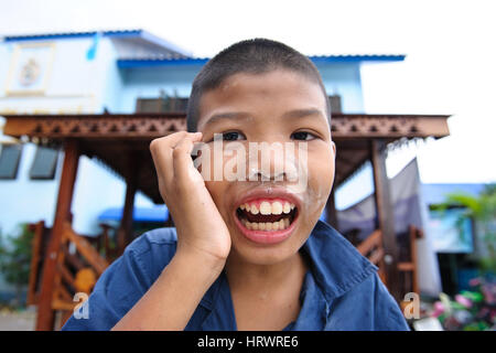 CHONBURI, THAILAND - AUGUST 23, 2014: Unidentified disability boy at Ban Kru Boonchoo. Ban Kru Boonchoo is the home for abandoned Down Syndrome kids. Stock Photo
