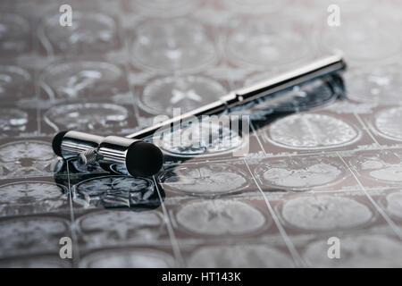 close up view of reflex hammer on x-ray picture Stock Photo