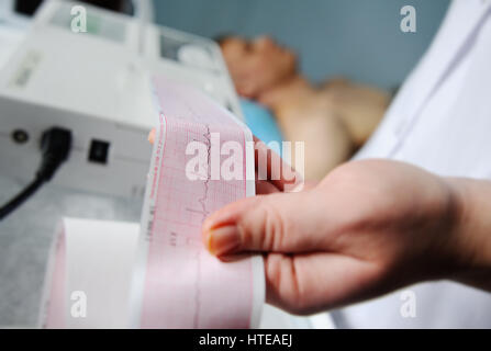 Electrocardiogram, ECG in hand. Clinic of Cardiology heart rate and pulse test closeup. Cardiogram printout on a male patient background Stock Photo