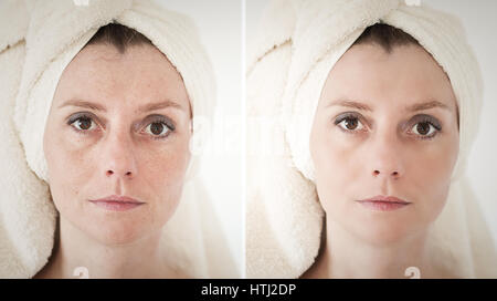 beauty concept - skin care, anti-aging procedures, rejuvenation, lifting, tightening of facial skin Stock Photo