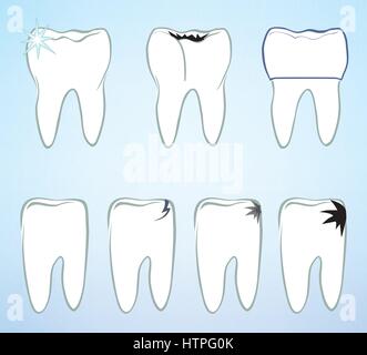 Tooth set. Teeth white sign. Dental medical isolated colection. Stock Vector