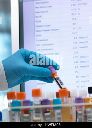 Medical Testing, Haematologist checking medical samples including blood for testing with results on the computer screen Stock Photo