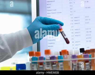 Blood analysis, Haematologist preparing medical samples including blood for testing with results on the computer screen Stock Photo