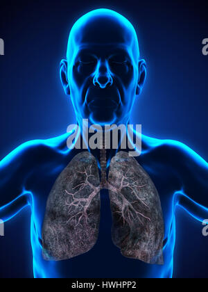 Elderly Male with Lung Cancer Illustration Stock Photo