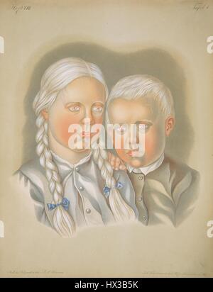 Lithograph showing two albino children, in 'Atlas der Hautkrankheiten' by Ferdinand Ritter von Hebra (1816-1880), 1856. Courtesy National Library of Medicine. Stock Photo