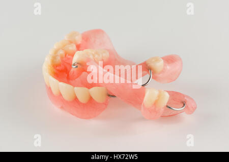 acrylic denture with metal clasps for restoring dentition Stock Photo