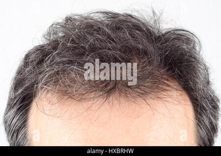 Mature man hair loss problem. health care shampoo and beauty product concep Stock Photo