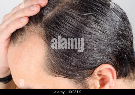 Mature man hair loss problem. health care shampoo and beauty product concep Stock Photo