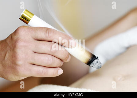 Moxa therapy in a natural welfare practise, Moxa-Therapie in einer Naturheilpraxis Stock Photo
