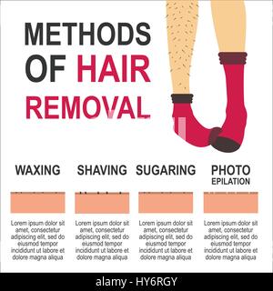 Depilation Vector illustration Poster template Women's legs in red socks with hair and after hair removal Types of depilation with description Stock Vector