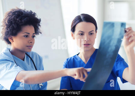 female doctors with x-ray image at hospital Stock Photo