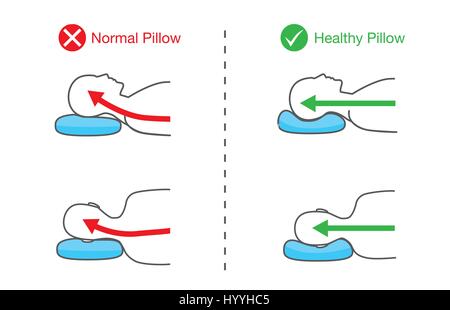 Spine line of people when sleep on different pillow. Stock Vector