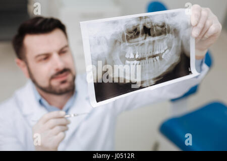 Conducting a research. Distinguished thorough professional doctor using an xray picture for diagnosing his patient before prescribing any treatment Stock Photo