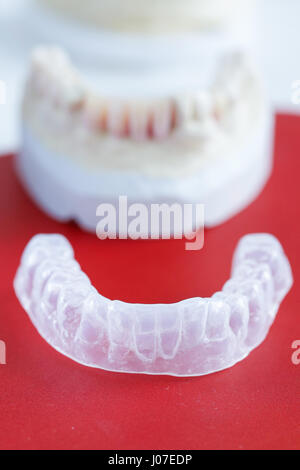 Invisalign, invisible plastic teeth aligner with dental plaster mold in the background Stock Photo
