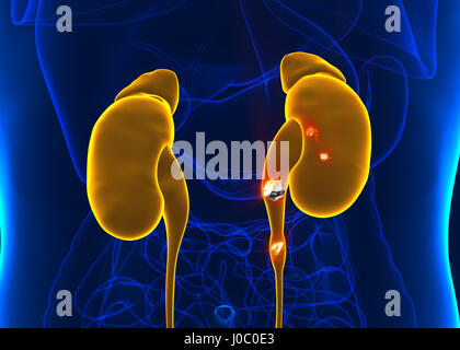 Kidney stones anatomy pain male internal organ painful cristaline mineral cross section - 3d illustration Stock Photo