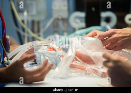 Tuebingen, Germany. 12th Apr, 2017. Doctors carry out a demonstration using a doll representing a prematurely born baby in the women's clinic in Tuebingen, Germany, 12 April 2017. 'Paul', a premature birth simulation system, can simulate a variety of scenarios and is used for training purposes in the hospital. Photo: Lino Mirgeler/dpa/Alamy Live News Stock Photo