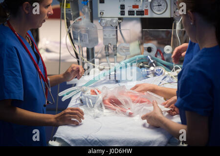 Tuebingen, Germany. 12th Apr, 2017. Doctors carry out a demonstration using a doll representing a prematurely born baby in the women's clinic in Tuebingen, Germany, 12 April 2017. 'Paul', a premature birth simulation system, can simulate a variety of scenarios and is used for training purposes in the hospital. Photo: Lino Mirgeler/dpa/Alamy Live News Stock Photo