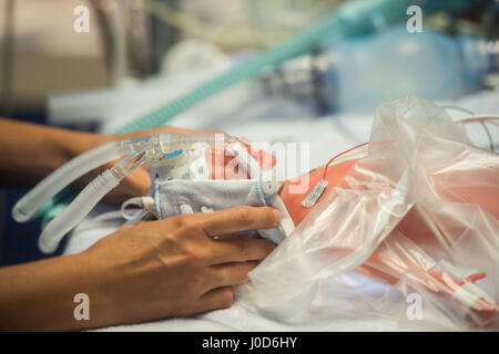 Tuebingen, Germany. 12th Apr, 2017. A doll representing a prematurely born baby lies on an operating table in the women's clinic in Tuebingen, Germany, 12 April 2017. 'Paul', a premature birth simulation system, can simulate a variety of scenarios and is used for training purposes in the hospital. Photo: Lino Mirgeler/dpa/Alamy Live News Stock Photo