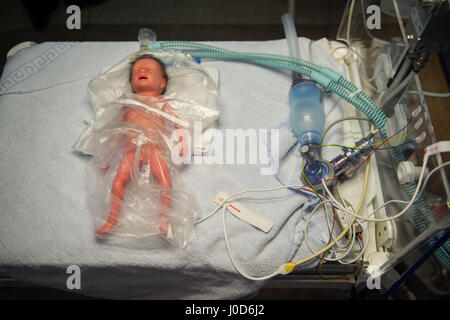 Tuebingen, Germany. 12th Apr, 2017. A doll representing a prematurely born baby lies on an operating table in the women's clinic in Tuebingen, Germany, 12 April 2017. 'Paul', a premature birth simulation system, can simulate a variety of scenarios and is used for training purposes in the hospital. Photo: Lino Mirgeler/dpa/Alamy Live News Stock Photo