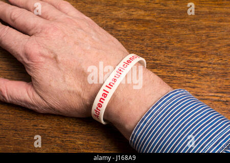 A medical alert wristband on a man's wrist - Adrenal Insufficiency Stock Photo